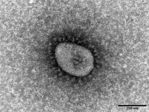 【資料写真】新型コロナウイルスのオミクロン株（国立感染症研究所提供）