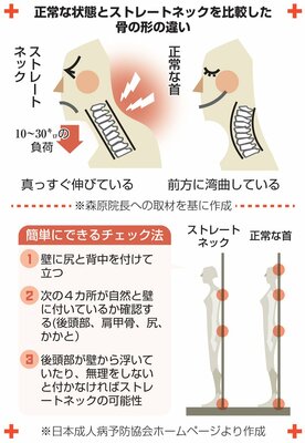 本当は怖い スマホ首 頭痛に吐き気 不眠までも 日常生活の注意点とトレーニング法は 医療 コロナ 地域のニュース 京都新聞