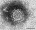 【資料写真】新型コロナウイルス（国立感染症研究所提供）